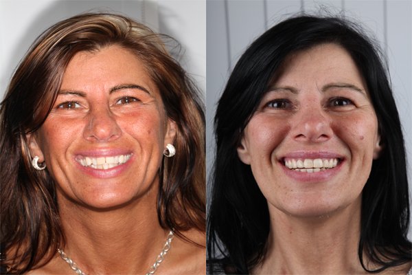 glenview dental treatment